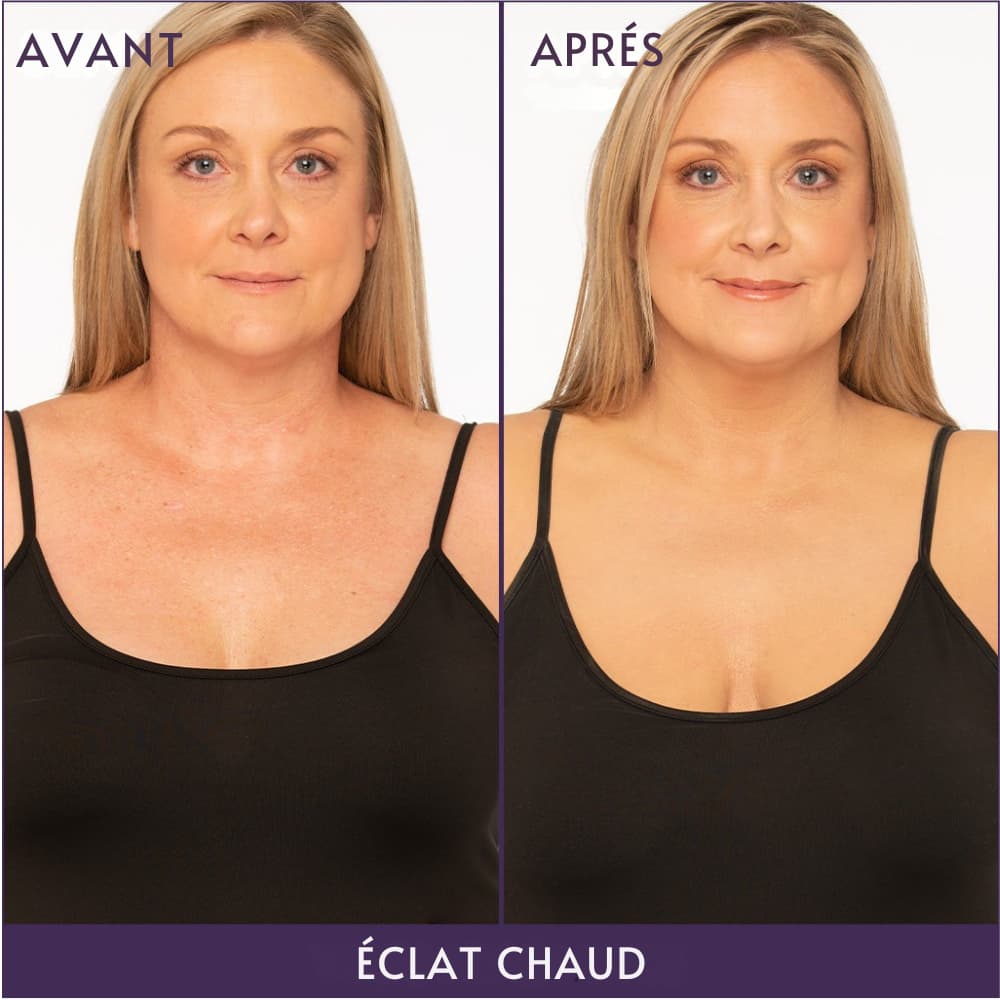 Lissea-Paris : "Adoptez une peau parfaite pour l'été"