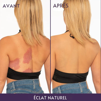 Lissea-Paris : Adoptez une peau parfaite pour l'été